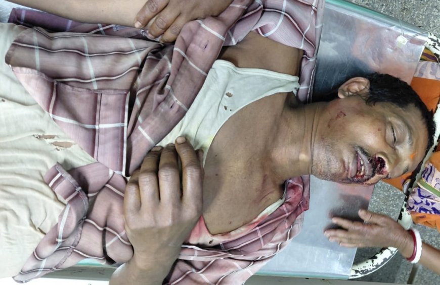 ইঞ্জিন ভ্যানের ধাক্কায় গুরুতর জখম সাইকেল আরোহী